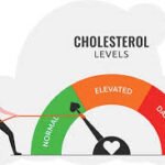 Cholesterol